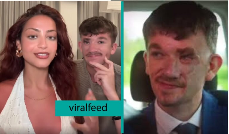 Jonny Heaver Disability: The Story Behind His Facial Difference And Resilience Jonny Heaver Disability